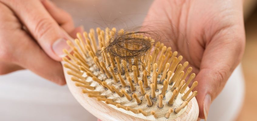 Image with a sign of hairloss
